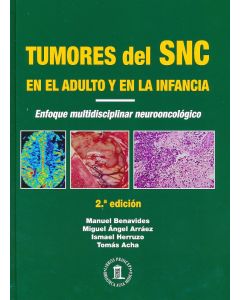 Tumores Del Sistema Nervioso Central En El Adulto Y En La Infancia. Enfoque Multidisciplinar Neuro Oncológico