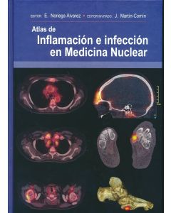 Atlas De Inflamación E Infección En Medicina Nuclear