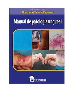 Manual De Patología Ungueal