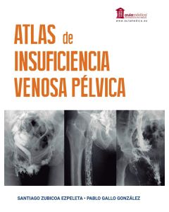 Atlas de Insuficiencia Venosa Pélvica