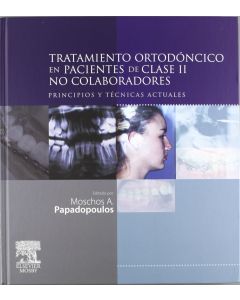 Tratamiento Ortodontico En Pacientes De Clase Ii No Colaboradores