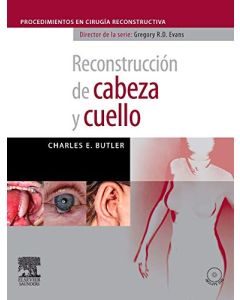 Reconstrucción De Cabeza Y Cuello