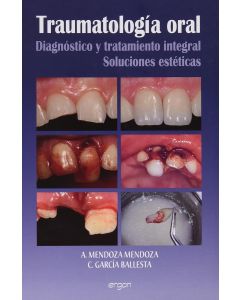 Traumatologia Oral