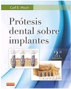 Prótesis Dental Sobre Implantes .