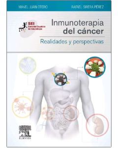 Inmunoterapia Del Cancer. Realidades Y Perspectivas