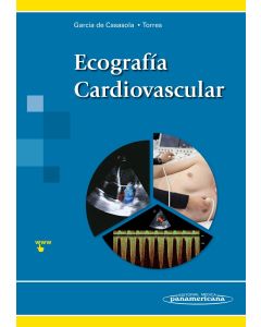 Ecografía Cardiovascular