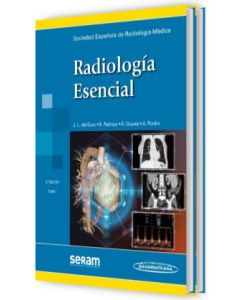 Radiología Esencial 2 Tomos