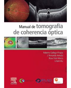 Manual De Tomografía De Coherencia Óptica