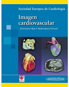 Imagen Cardiovascular