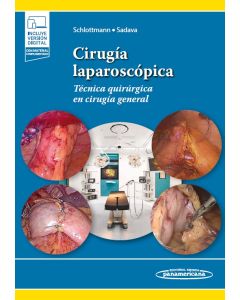 Cirugía Laparoscópica. Técnica Quirúrgica en Cirugía General