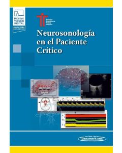 Neurosonología en el Paciente Crítico