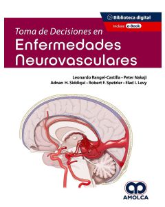 Toma de Decisiones en Enfermedades Neurovasculares