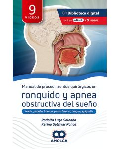Manual de Procedimientos Quirúrgicos en Ronquido y Apnea Obstructiva del Sueño