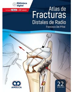 Atlas de Fracturas Distales de Radio