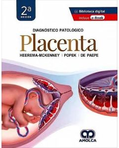 Diagnóstico Patológico. Placenta
