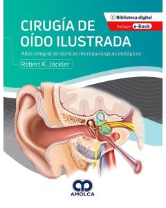 Cirugía de Oído Ilustrada