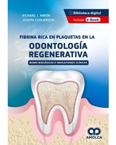 Fibrina Rica en Plaquetas en la Odontología Regenerativa