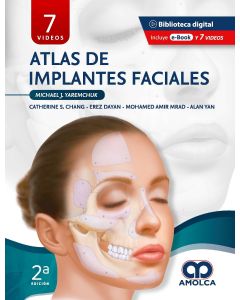 Atlas de Implantes Faciales