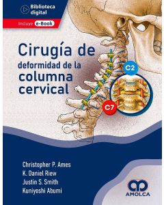Cirugía de la Deformidad de la Columna Cervical