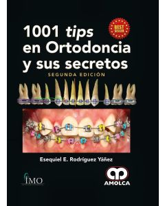 1001 Tips en Ortodoncia y Sus Secretos
