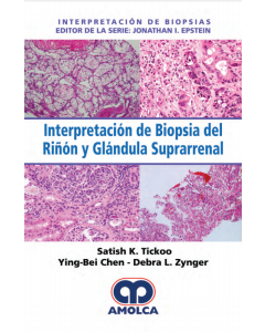 Interpretación de Biopsia del Riñón y Glándula Suprarrenal