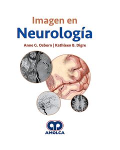 Imagen en Neurología