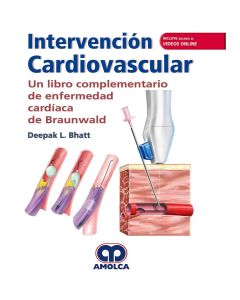 Intervención Cardiovascular