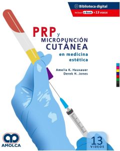 PRP y Micropunción Cutánea en Medicina Estética