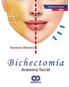 Bichectomía. Armonía Facial