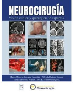 Neurocirugía. Visión Clínica y Quirúrgica de Expertos