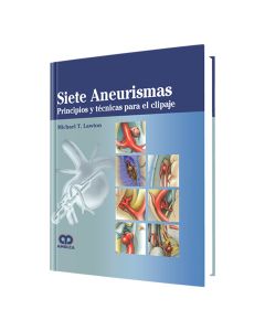 Siete Aneurismas