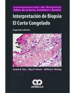 Interpretación de Biopsia. El Corte Congelado (Interpretación de Biopsias)