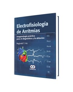 Electrofisiología de Arritmias