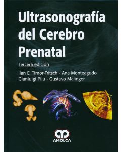 Ultrasonografía del Cerebro Prenatal