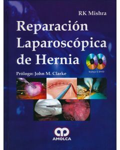 Reparación Laparoscópica de Hernia