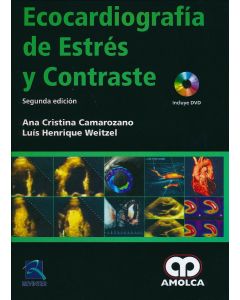 Ecocardiografía de Estrés y Contraste