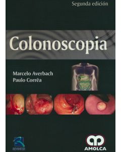 Colonoscopia