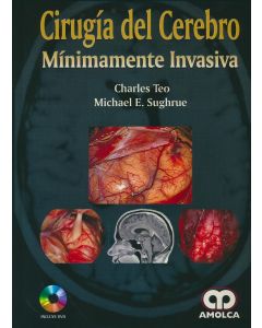 Cirugía del Cerebro Mínimamente Invasiva