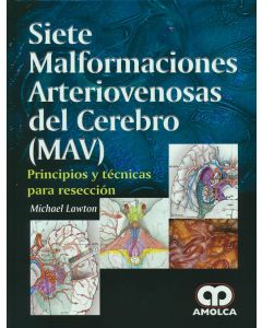 Siete Malformaciones Arteriovenosas del Cerebro (MAV)
