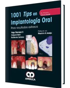 1001 Tips en Implantología Oral