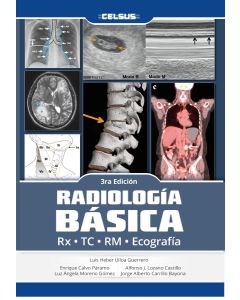 Radiología Básica Rx Tc Rm Ecografía