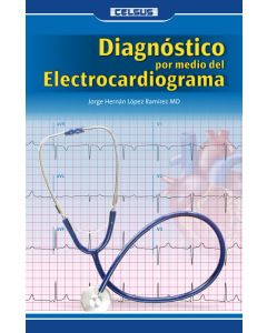 Diagnóstico por medio del Electrocardiograma
