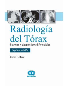 Radiología del Tórax