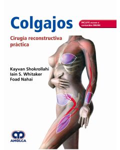 Colgajos. Cirugía Reconstructiva Práctica