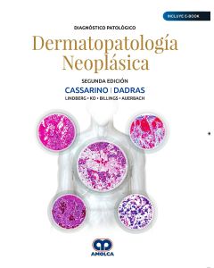 Diagnóstico Patológico. Dermatopatología Neoplásica