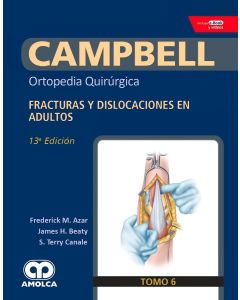 CAMPBELL Ortopedia Quirúrgica, Tomo 6: Fracturas y Dislocaciones en Adultos