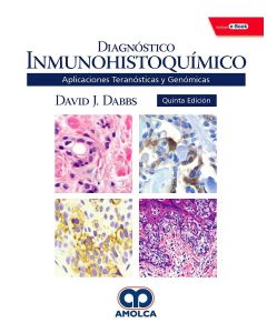 Diagnóstico Inmunohistoquímico