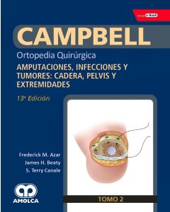 CAMPBELL Ortopedia Quirúrgica, Tomo 2: Amputaciones, Infecciones y Tumores: Cadera, Pelvis y Extremidades