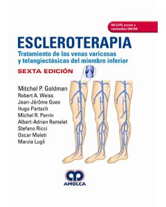 Escleroterapia