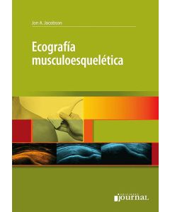 Ecografía Musculoesquelética